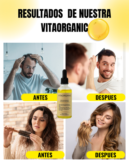 VITAORGANIC – Aceite Natural para el Crecimiento del Cabello