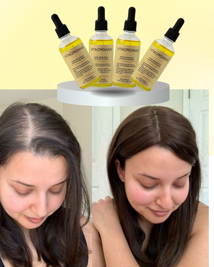 VITAORGANIC – Aceite Natural para el Crecimiento del Cabello