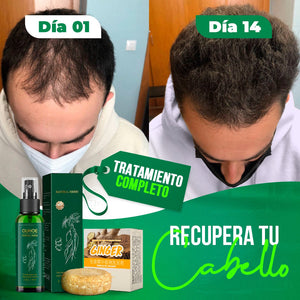 Nuevo OUHOE Para El Crecimiento Del Cabello